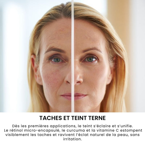 OVALIANCE – Masque de nuit Coréen au curcuma et au collagène