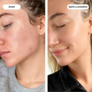 OVALIANCE - Masque au Bio-Collagène