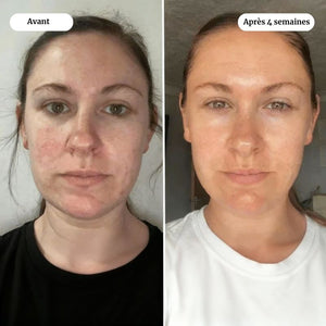 OVALIANCE - Masque au Bio-Collagène