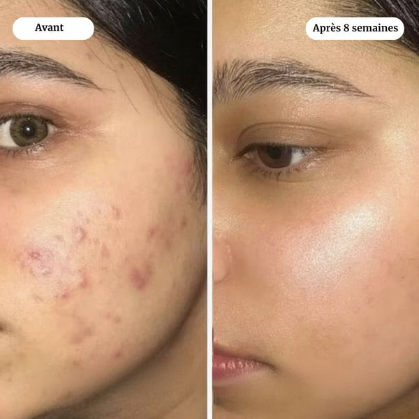 OVALIANCE - Masque au Bio-Collagène